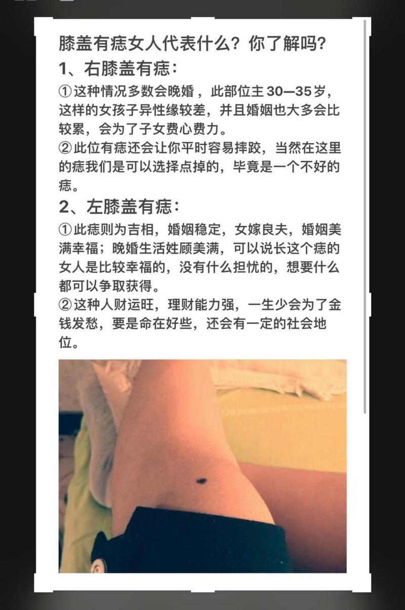 腿上長(zhǎng)痣