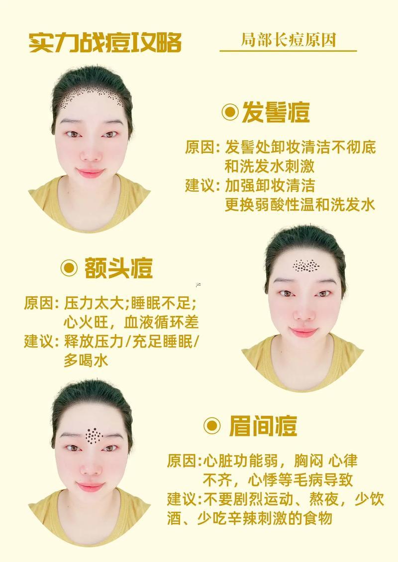 左臉頰有痣