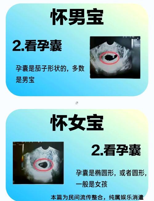 怎么測(cè)懷得男孩女孩