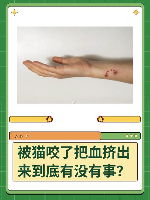 女人夢見貓咬自己接著打死了