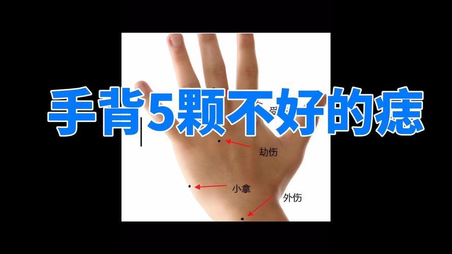 手背有痣得女人