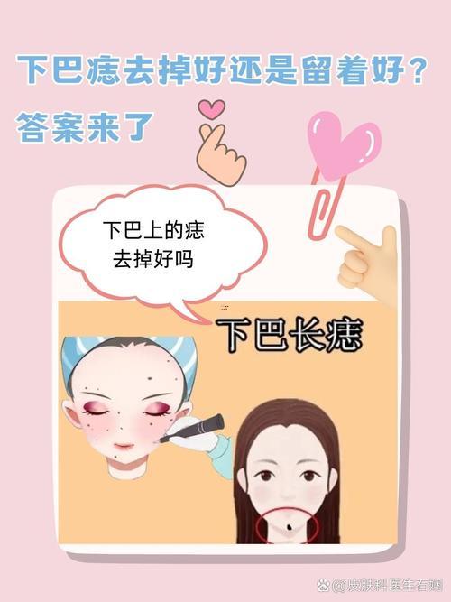 下巴有顆痣