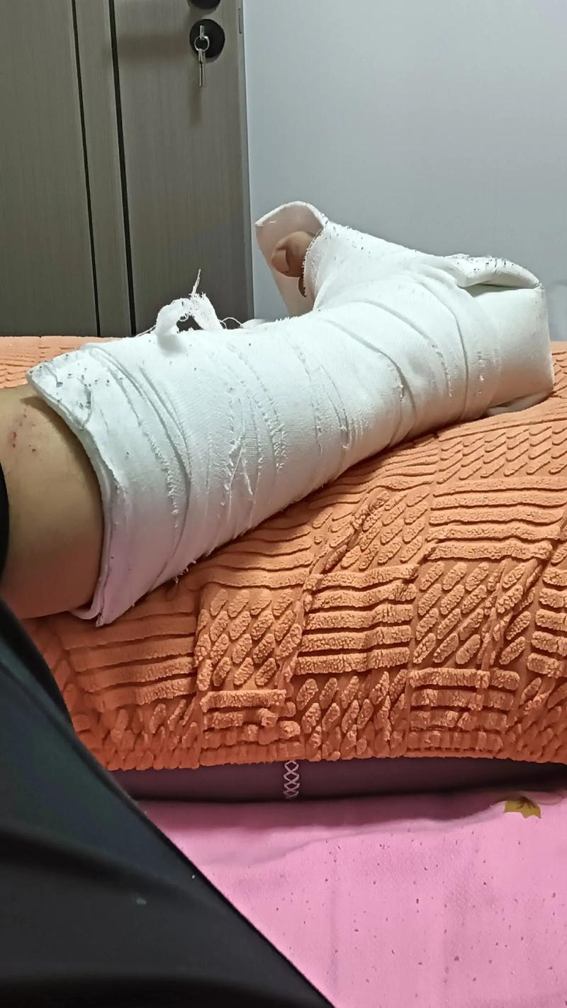 夢見腿受傷