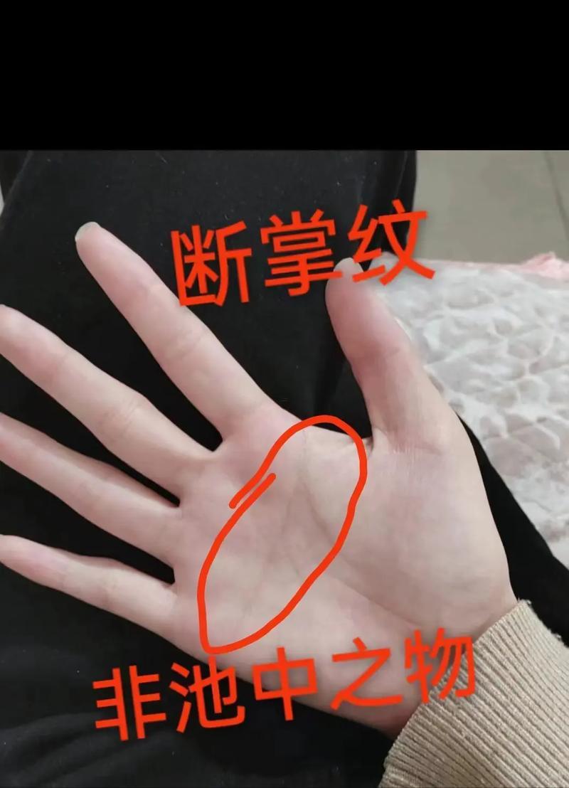 男孩斷掌