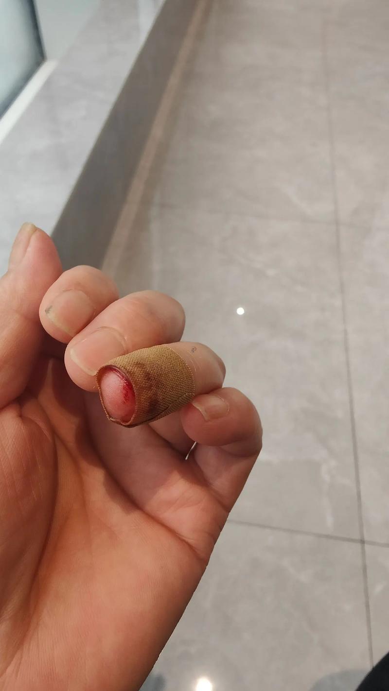 被別人夢到自己受傷是什么東西意思