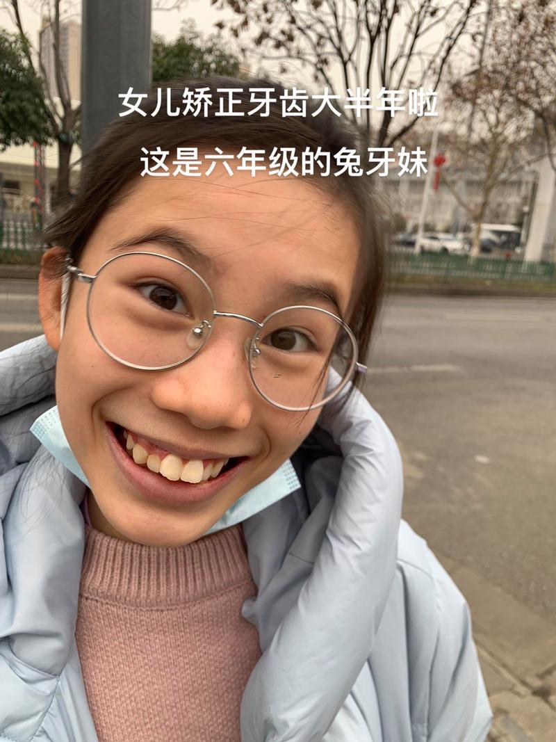 門牙太大