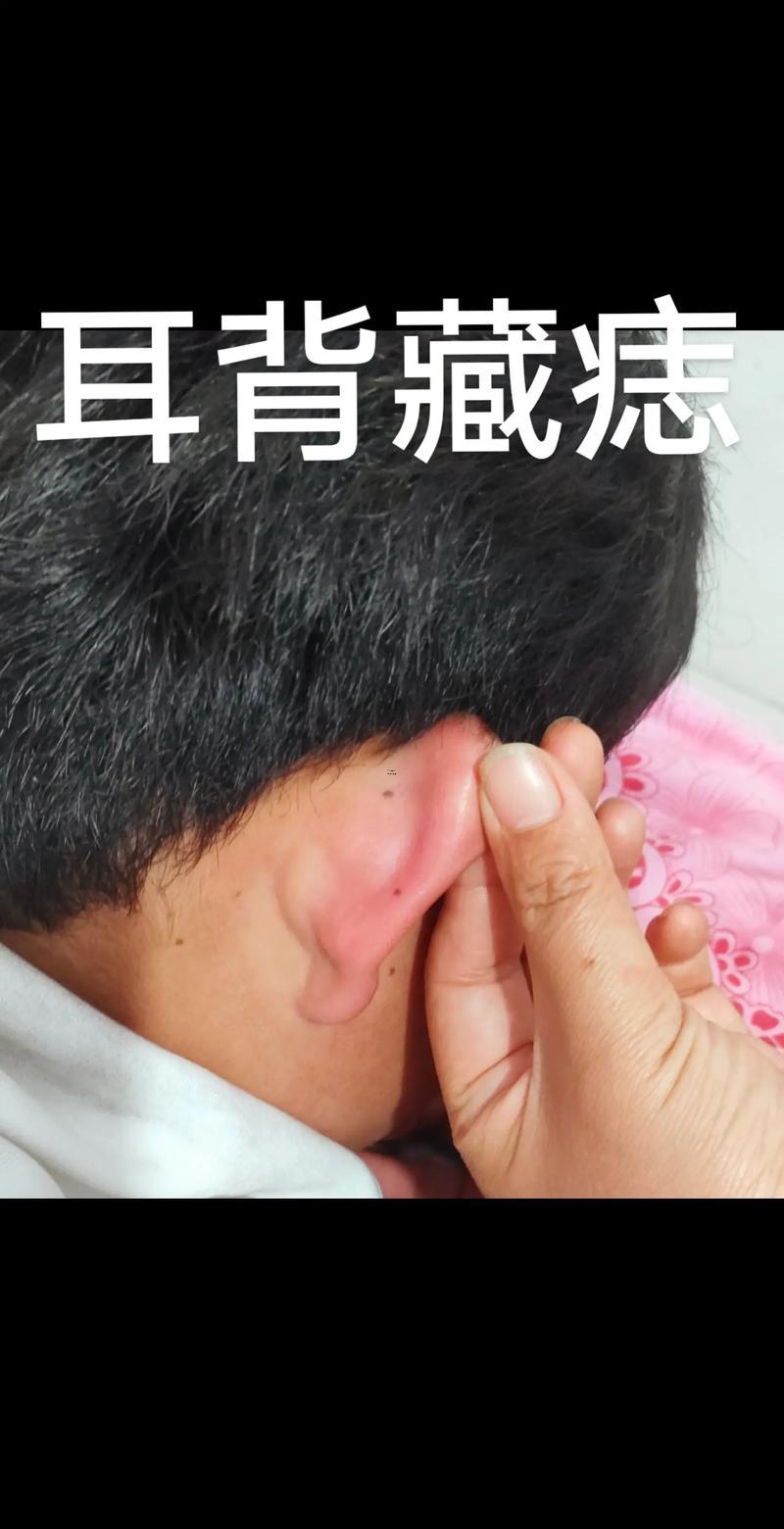 耳背有痣的男人