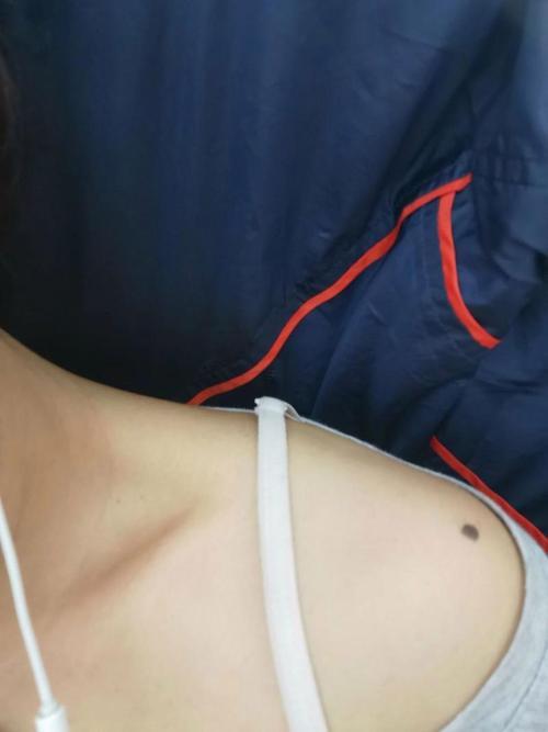 左手臂有痣的女人