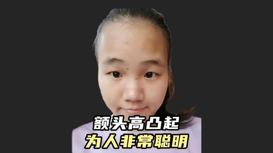 額頭高怎么改善