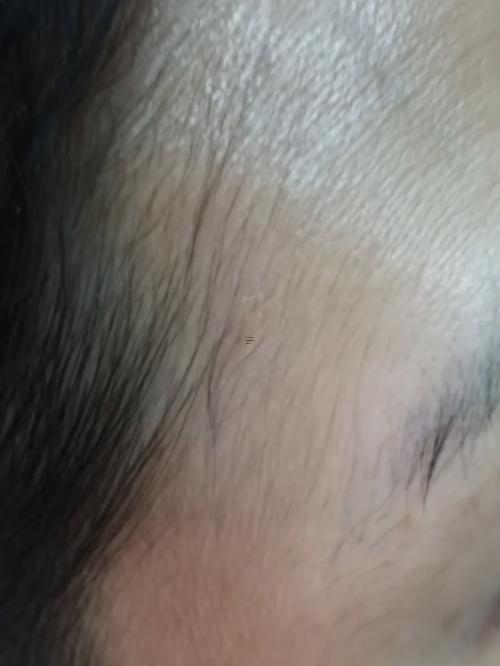 額頭上絨毛是福氣