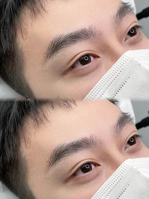 兩眉間有豎紋