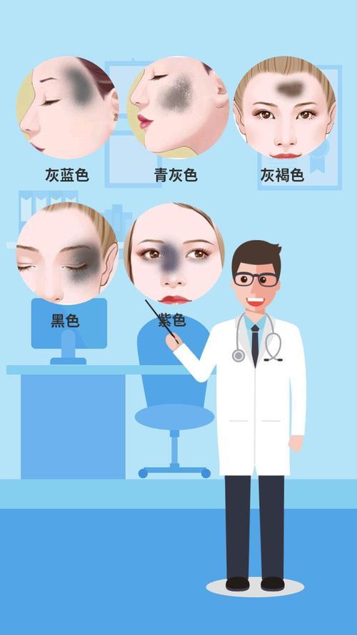 青色胎記的傳說