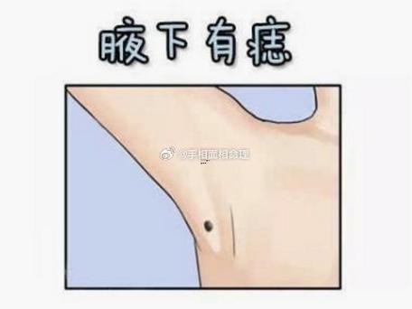 腋下有痣