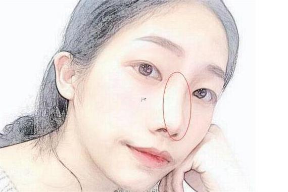 鼻子歪面相