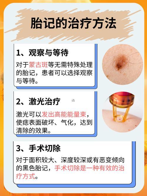 胎記得位置與命運(yùn)