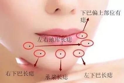 下巴長痣代表啥