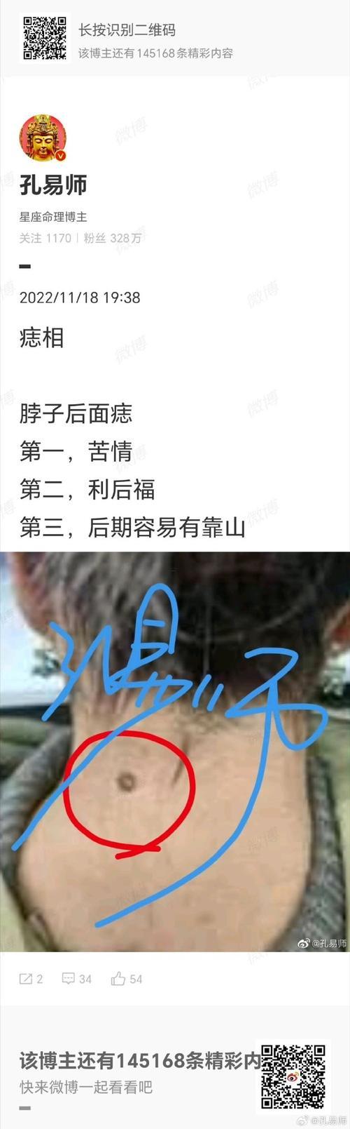 眉毛里有痣