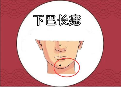 下巴有痣好不好
