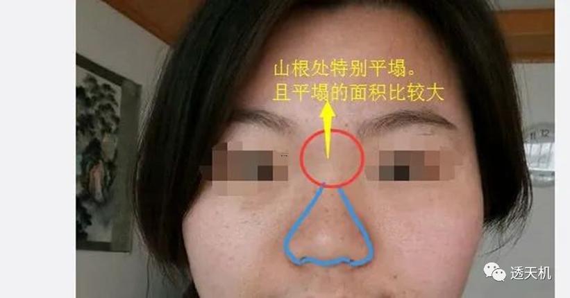 蒜頭鼻面相