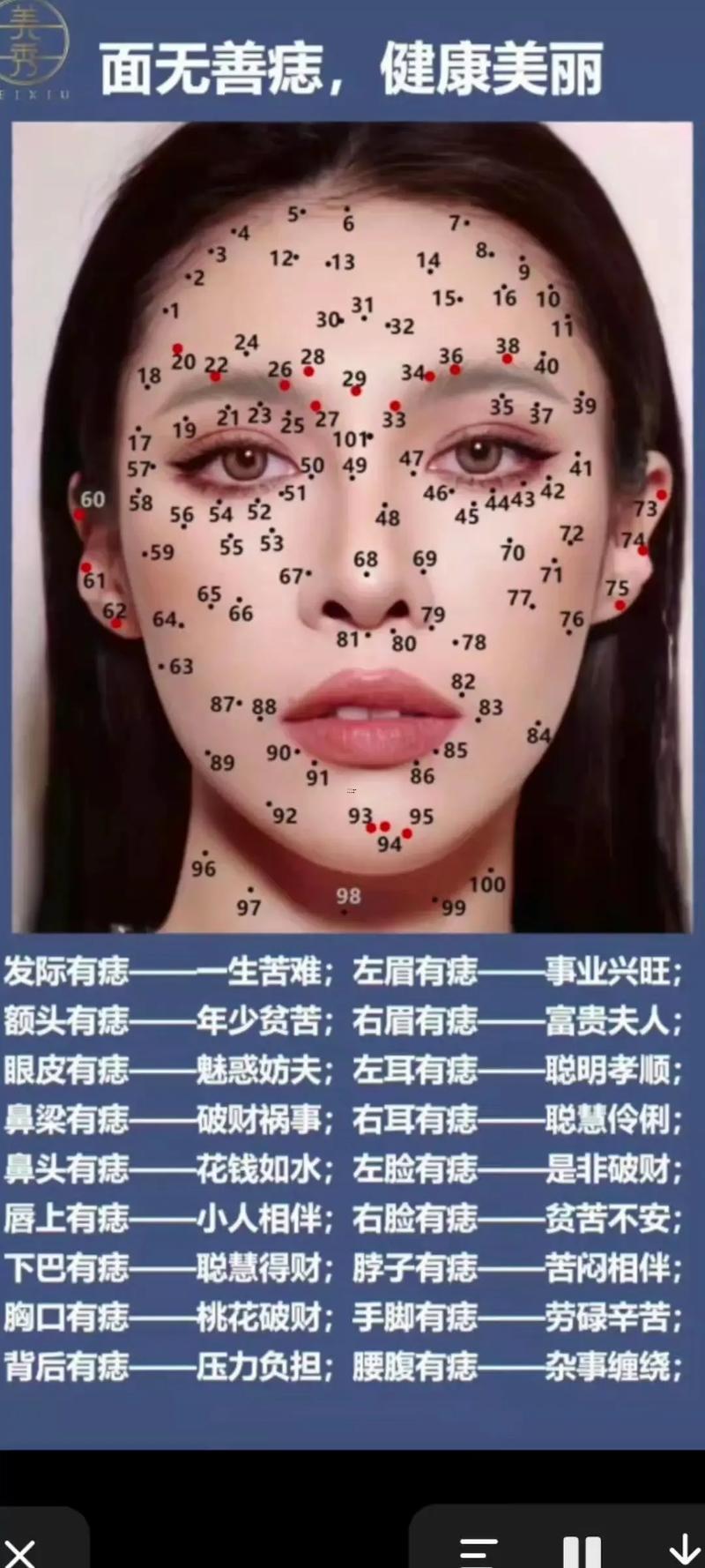 痣面相圖