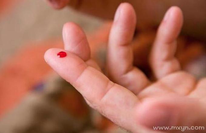 男人夢(mèng)到被蛇咬手是什么東西東西意思