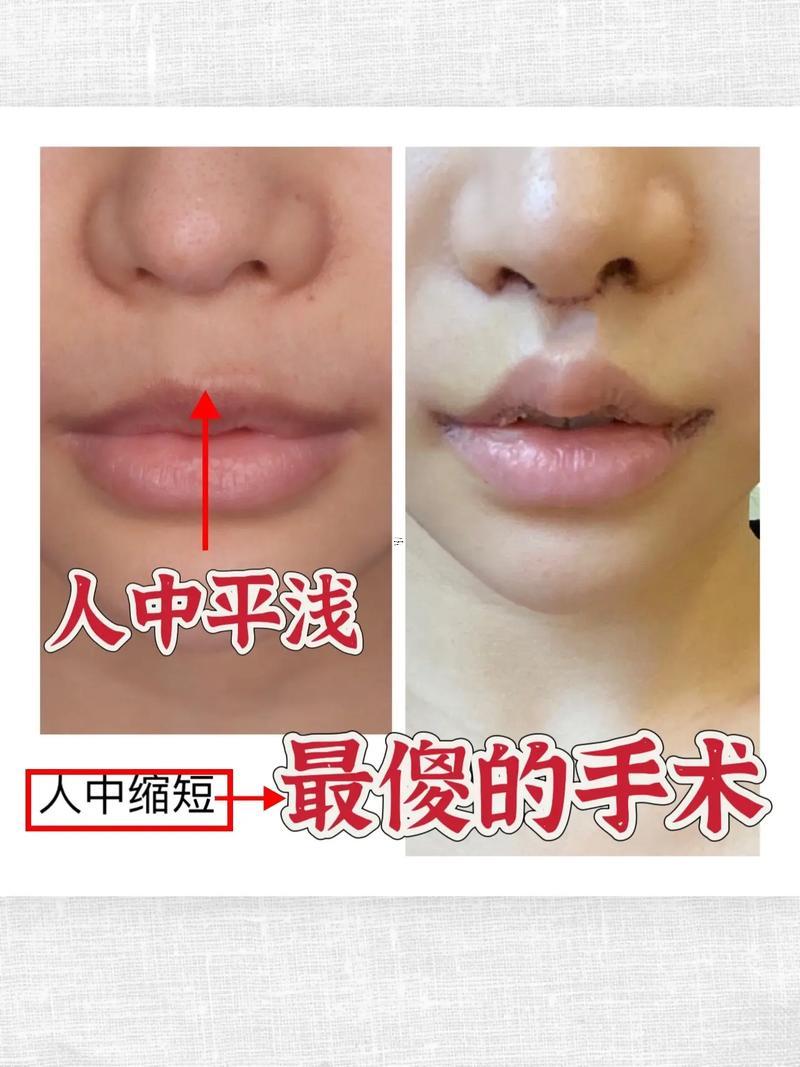 人中很厚是啥面相