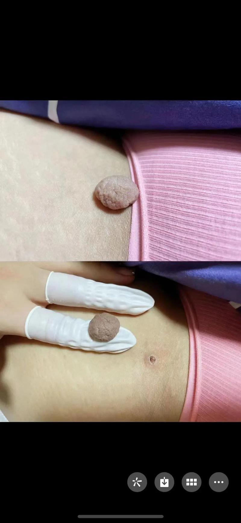 鬢角有痣