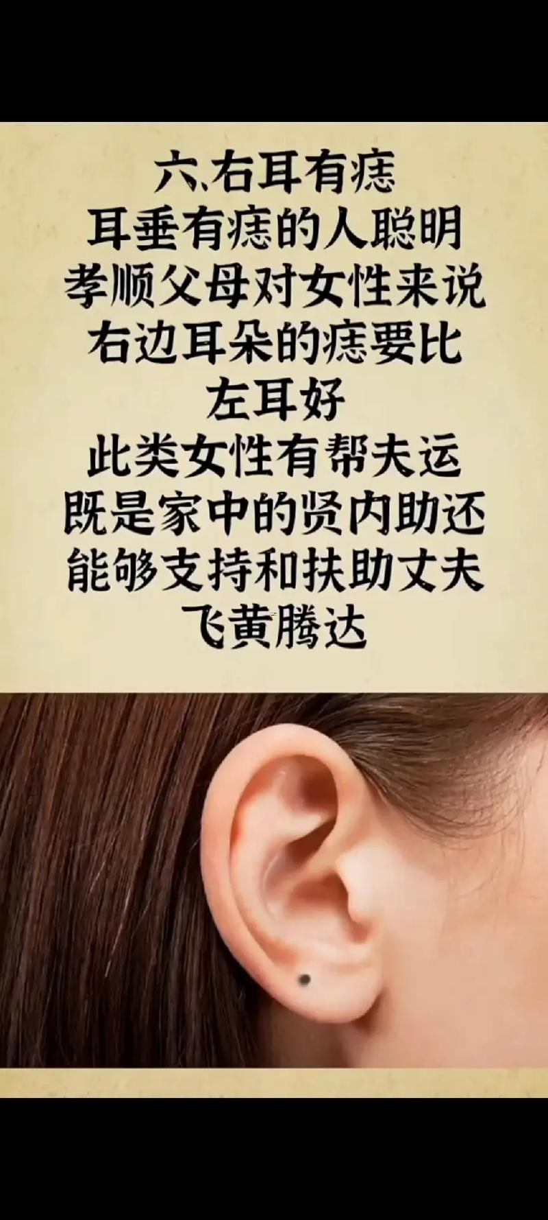 右耳有痣