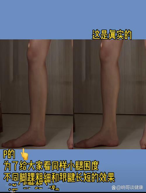 沒有腳后跟