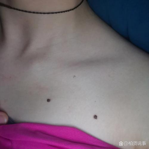 胸口有痣的女人