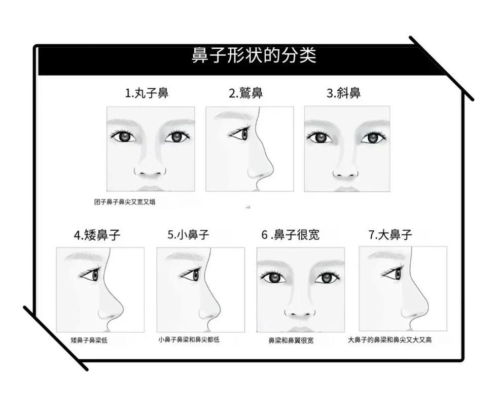 鼻子類型圖