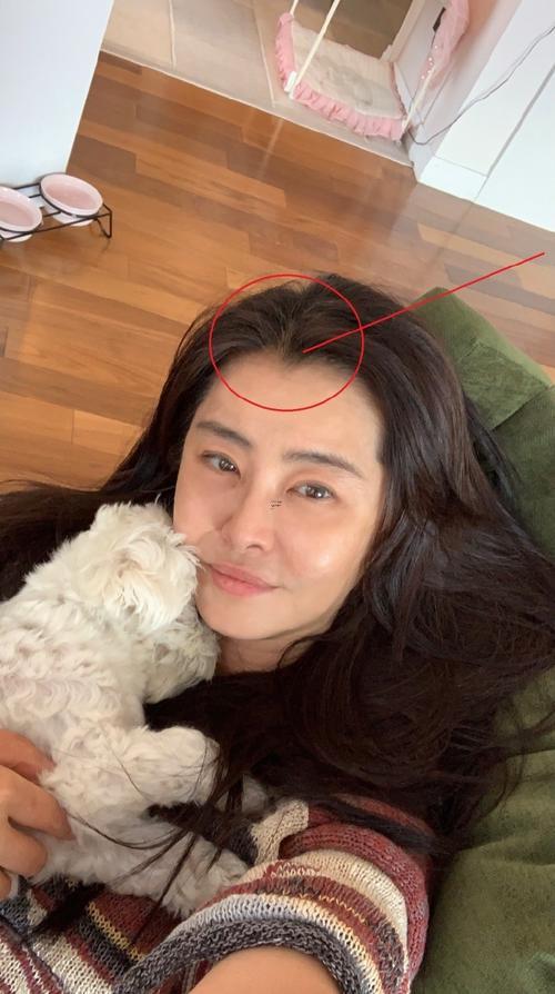 美人尖有什么益處