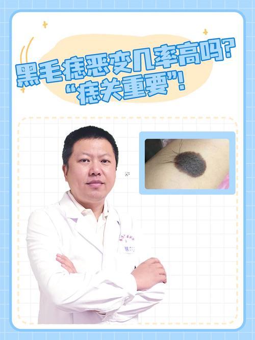 長毛的痣