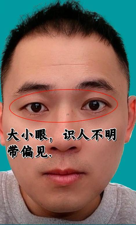 下巴有溝