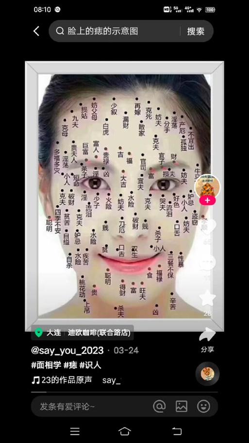 嘴上的痣