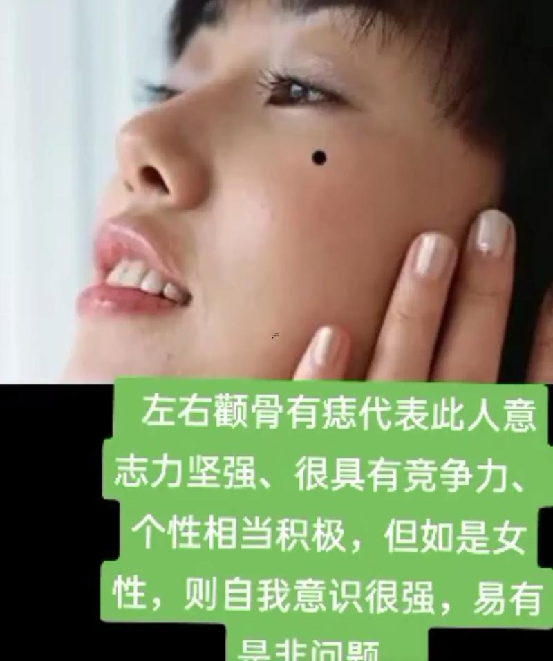 下眼瞼有痣