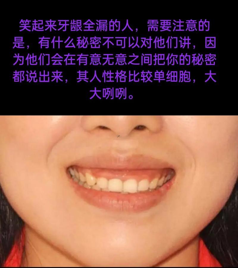 笑露牙齦
