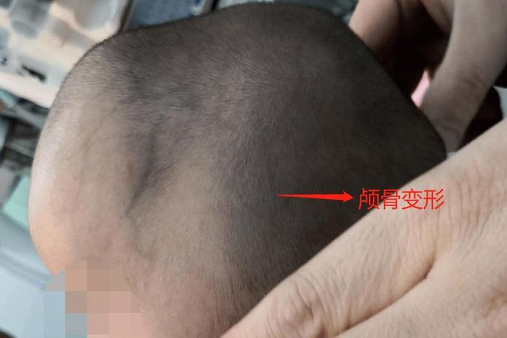 頭骨很顯著
