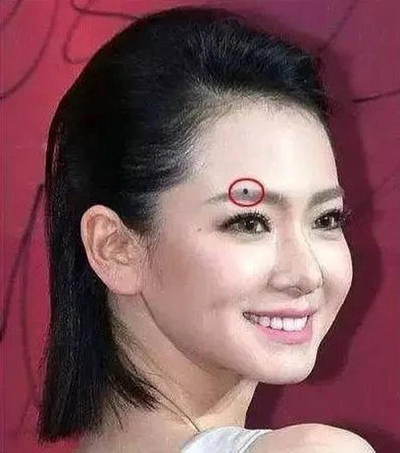 眉毛上方有痣
