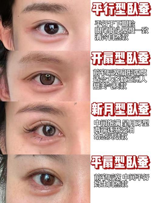 臥蠶是啥