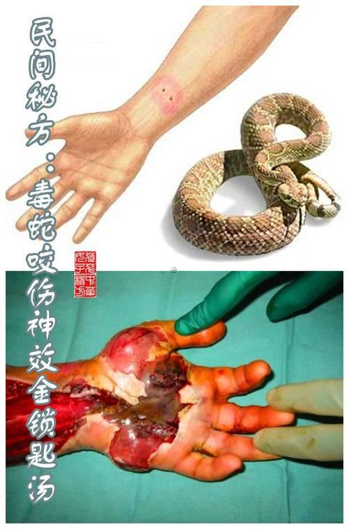 夢見蛇咬我被別人打死了