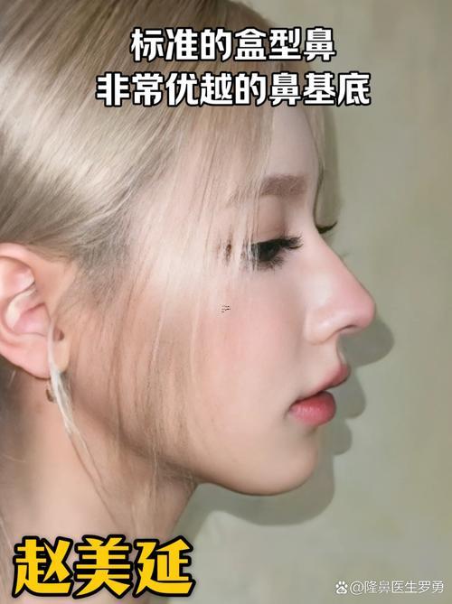 女人鼻子大代表啥