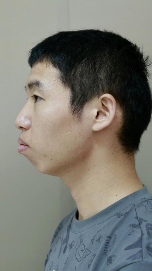 面相下巴翹起