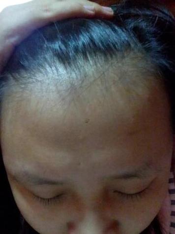女生額頭上部凸起面相