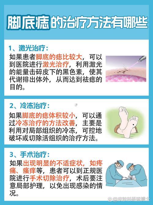 女人腳底有痣