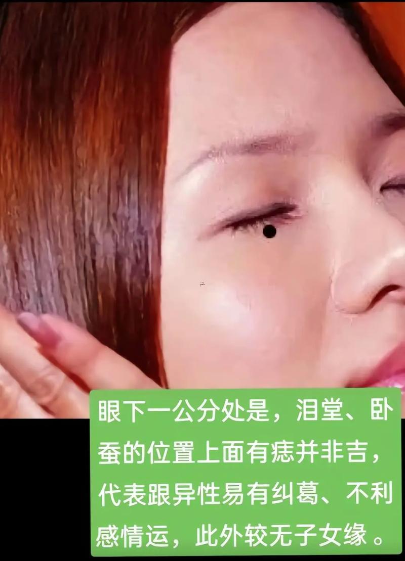 女人左眼皮有痣圖解