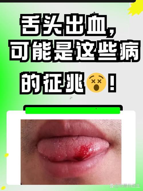 夢到吐血