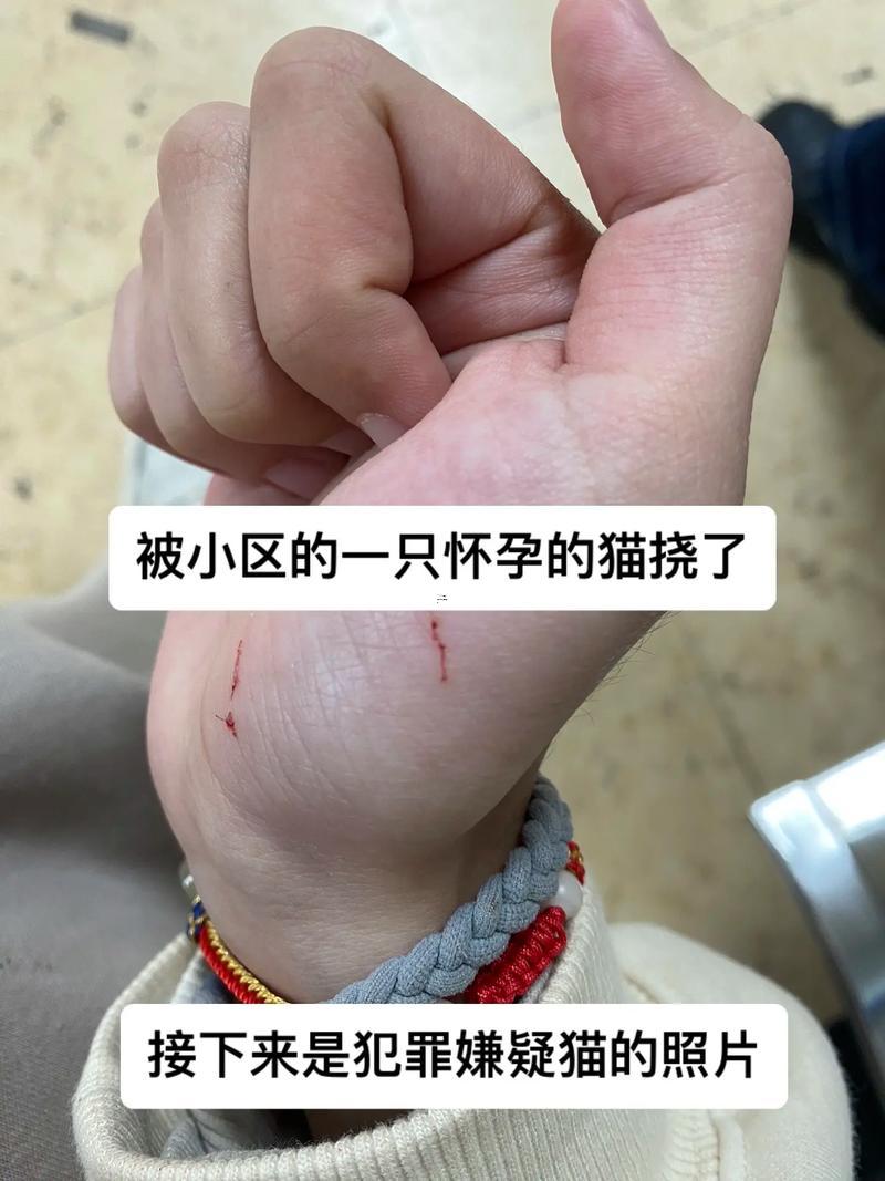 夢見被貓抓了