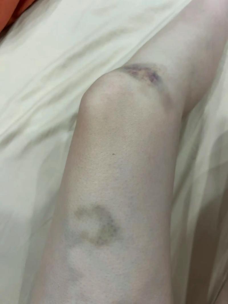 夢(mèng)見被車撞