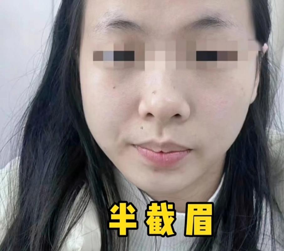 眉毛上方兩個鼓包面相